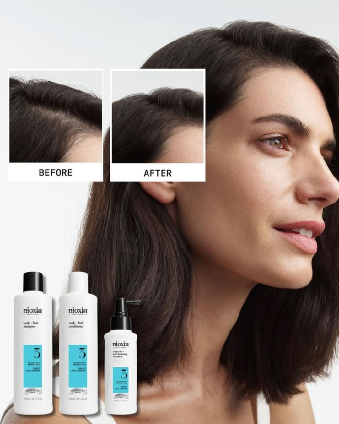 hair loss experts in Peterborough at Studio 74 hair loss experts in Peterborough at Studio 74