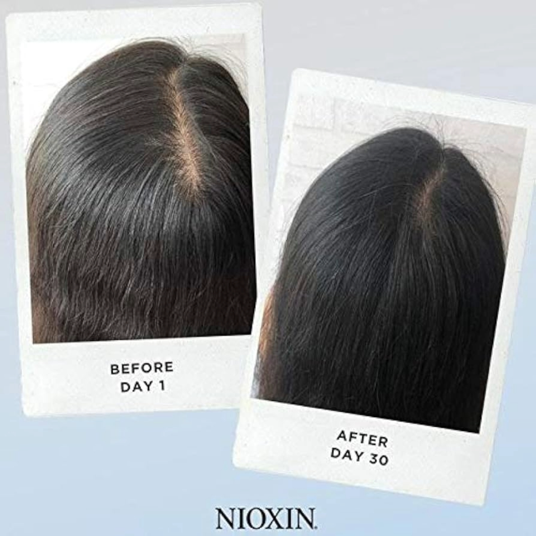 hair loss treatments in Peterborough hair loss treatments in Peterborough