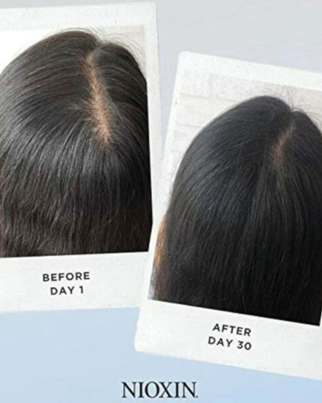 Scalp Analysis with Nioscope Technology at Studio 74 Salon in Peterborough Scalp Analysis with Nioscope Technology at Studio 74 Salon in Peterborough